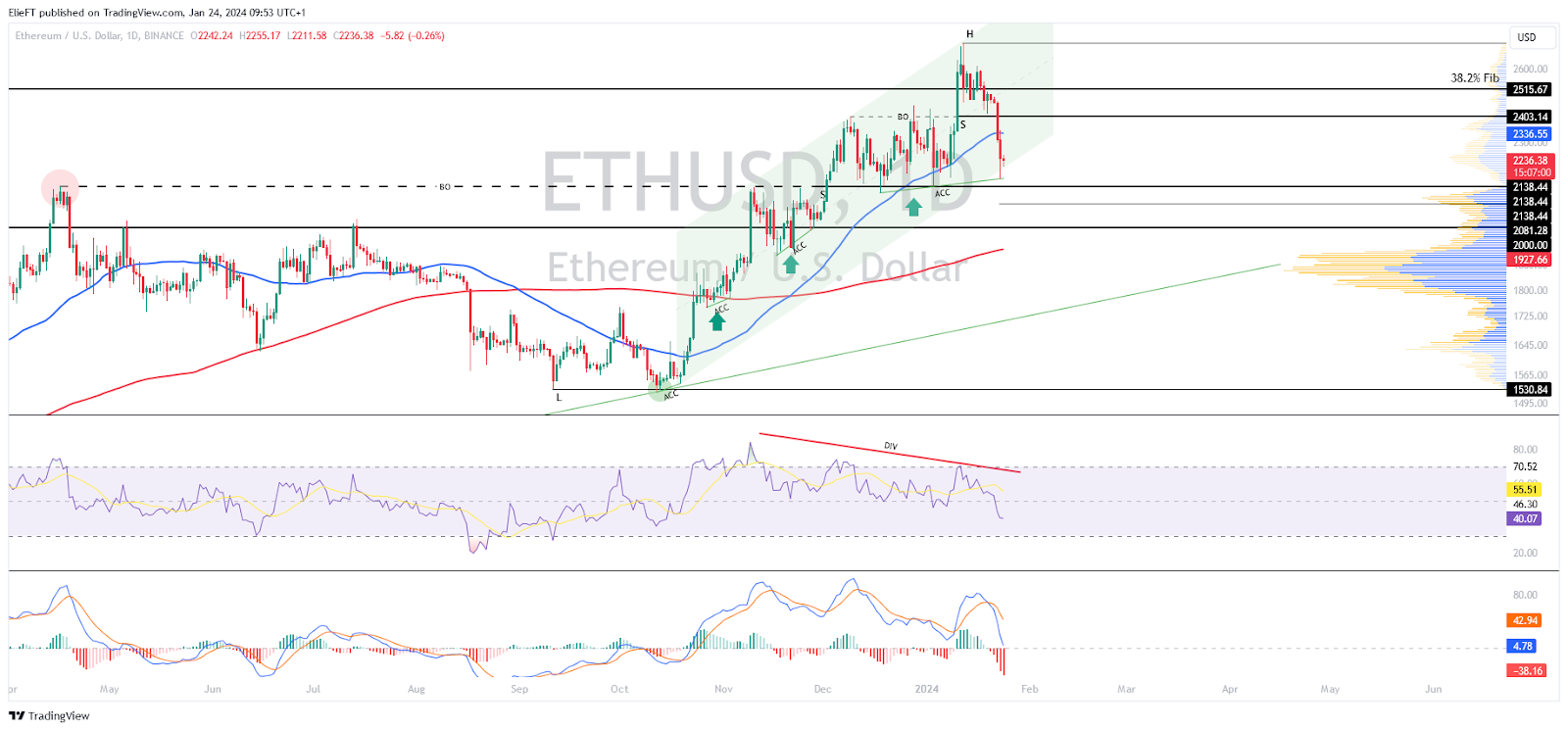 Ethereum (ETH) Technical Analysis Daily, Ethereum Price Forecast and Reports